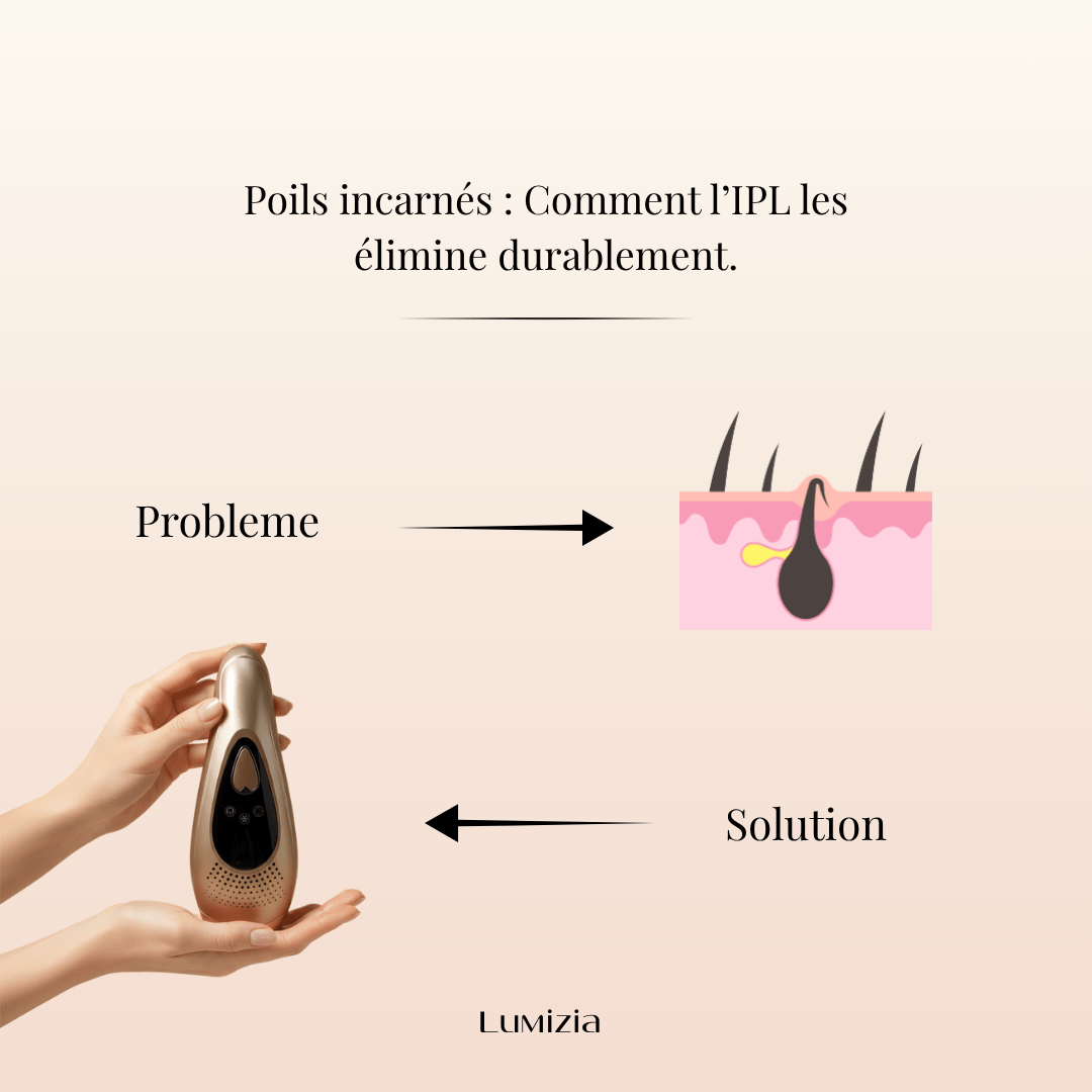 Poils Incarnés : Solution Durable IPL 2025 - Lumizia